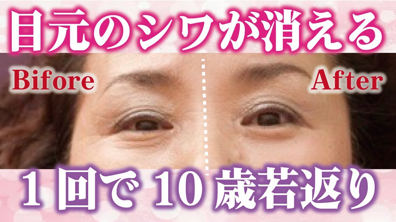 目元のシワを1回で徹底的に消す 老化を防いで10歳若返るセルフケアルーティン Youtube