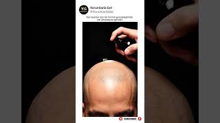 Kafası Kel Olan Arkadaşına Gönder