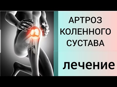 Videó: Kondroprotektorok Arthrosisra