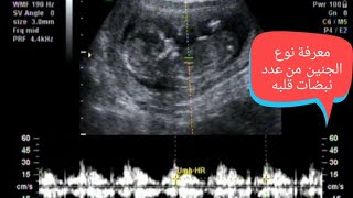 معرفة نوع الجنين عن طريق عدد نبضات قلبه في السونار من أول شهور الحمل