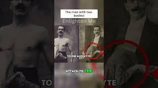 The Bizarre Case of the Double-Bodied Man Details