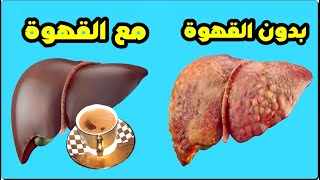 هل شرب القهوة يحمى الكبد وهل القهوة مفيدة لمرضى الكبد وكم مرة يجب تناول القهوة؟