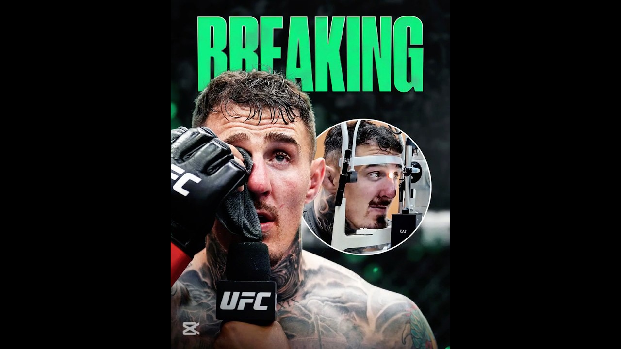 🚨UFC321: Tom Aspinall did not sustain any dengrous eye damage upon initial diagnosis 🙌🫣