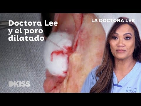 Lee reventar granos dra