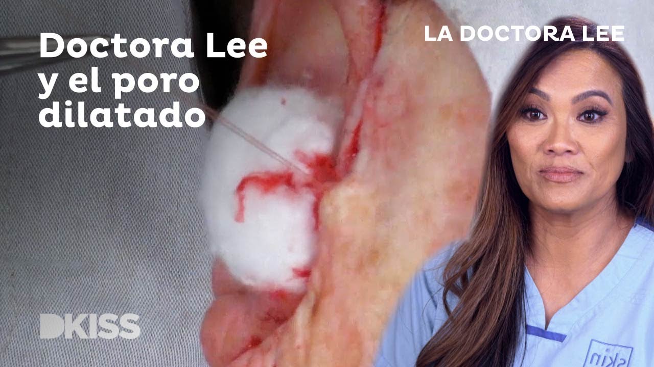 Reventar granos dra lee