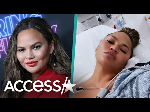 Video: Si Chrissy Teigen Na Magpa-opera Ng Endometriosis Sa Linggong Makakarating Na Anak