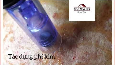 Phi kim tế bào gốc giá bao nhiêu