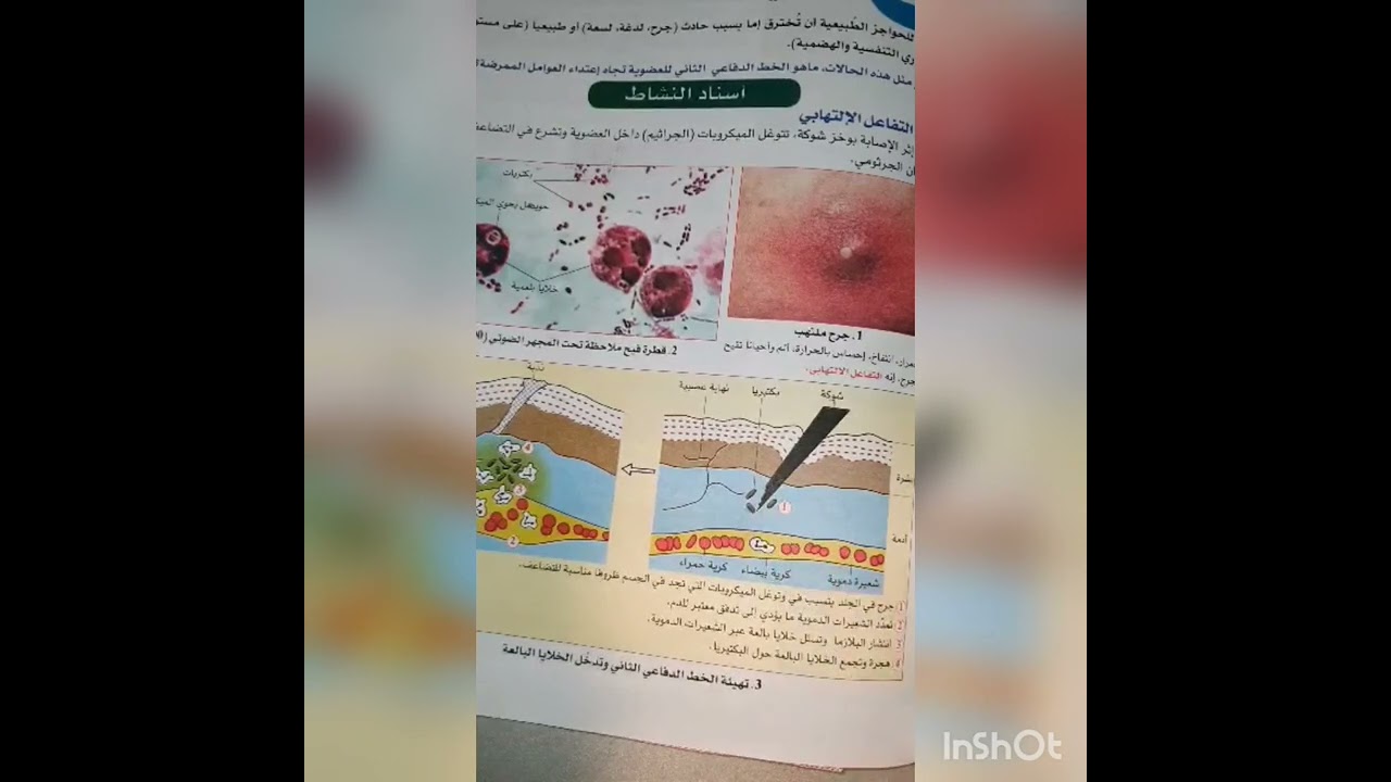 التفاعل الالتهابي سنة رابعة متوسط
