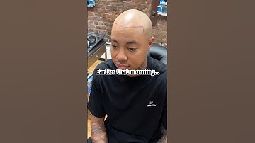 The Benefits of Scalp Micro #scalpmicropigmentation