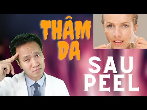 Peel da - 5 điều giúp bạn hạn chế thâm sau peel mặt| Dr Hiếu