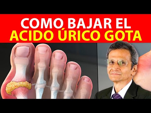 Video: Piedras de urato en perros