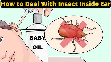 How to Deal With Insects Inside Ear