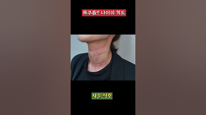 목주름 필러 효과를 못 보셨다면? 이거 안 해서 그렇습니다. | 한달차 효과 *모든 시술/수술은 부작용이 있을 수 있습니다 #모즈클리닉