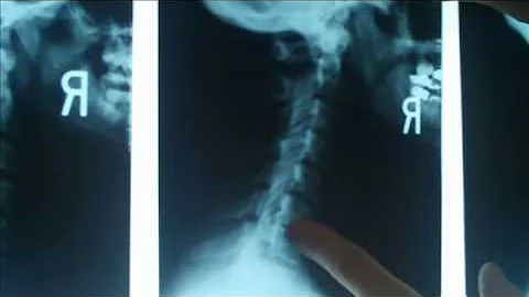 Long Term Chiropractic Results in Outer Banks