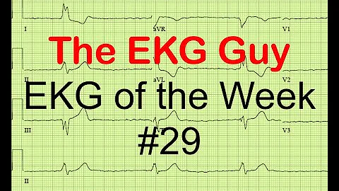 EKG/ECG of the Week #29 | The EKG Guy - www.ekg.md