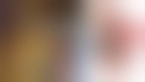 Lap Partial Nephrectomy for Intra-parenchymal tumor without clamping using Laparoscopic Ultrasound