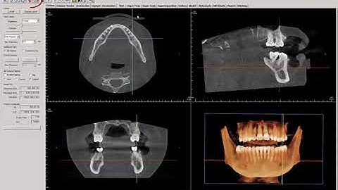 Invivo™ 5.4 Training Series: An Introduction to Invivo™ 5.4.5 Basics