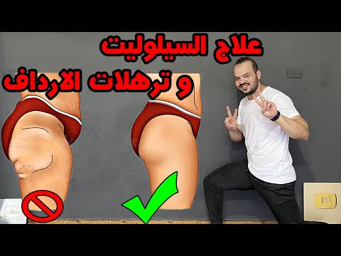 افضل  تمارين لعلاج السيوليت في البيت تخلص من دهون و ترهلات الارداف و ال