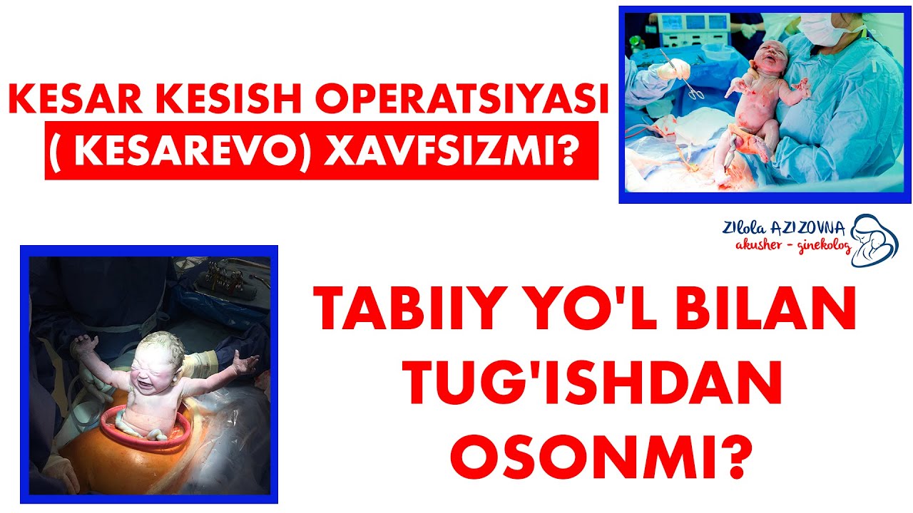 Kesar kesish operatsiyasi (KESAREVO) xavfsizmi ?