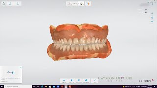 Reference Denture Intraoral Scans