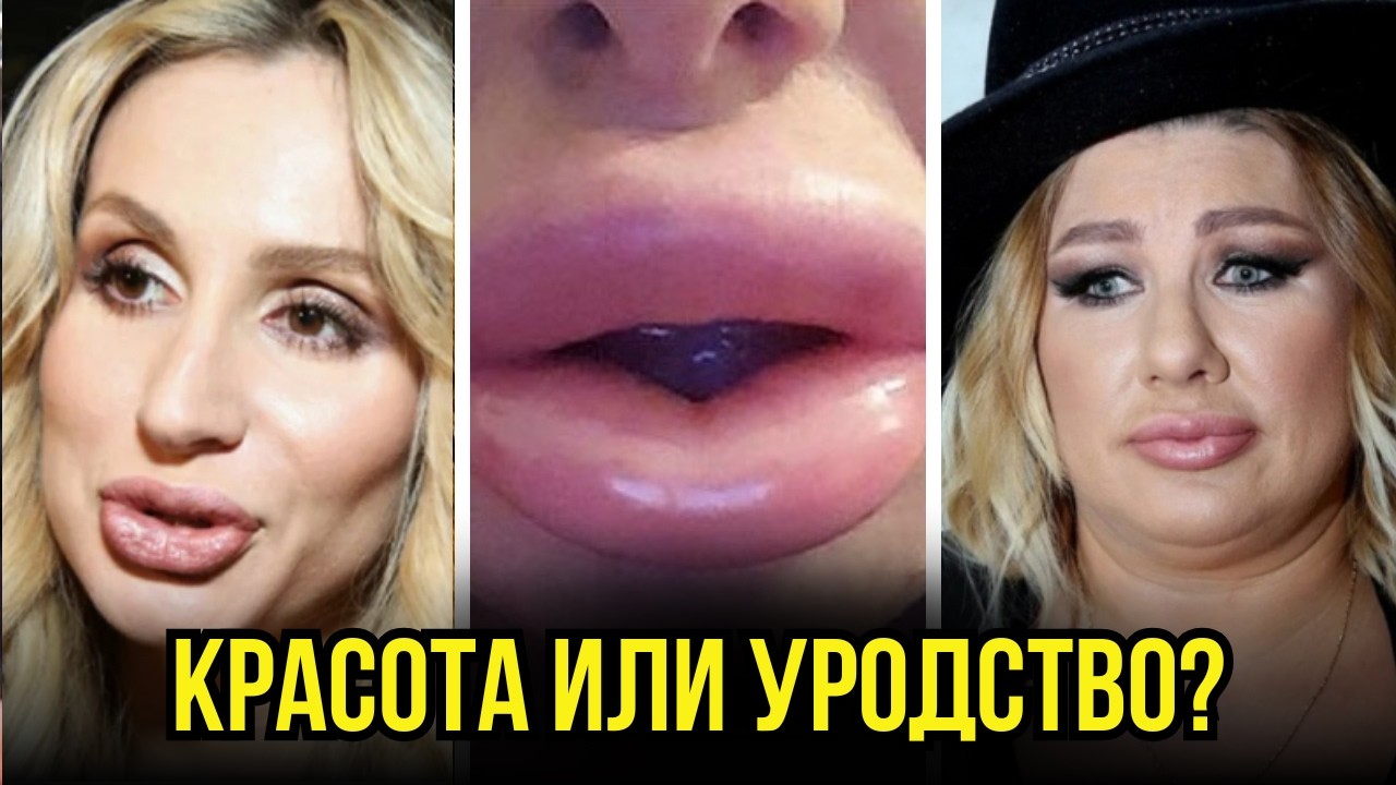 ЗРЯ НАДУЛИ ГУБЫ! Звезды и их ужасное увеличение губ. 20 знаменитостей, увеличивших губы