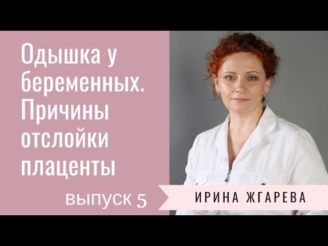 Одышка у беременных. Причины отслойки плаценты