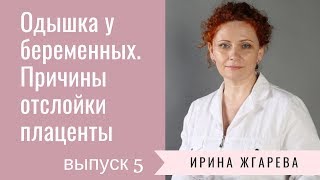 Одышка у беременных. Причины отслойки плаценты
