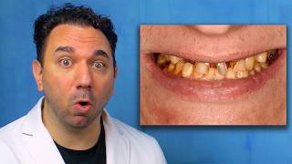 Top 5 Dental Implant Makeovers | World Renowned Dr. Amar Katranji & Dr Mark McCawley Discuss