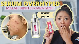 REVIEW SERUM VIRAL: WHITELAB, WARDAH HYDRA ROSE, SOMETHINC HYALURONIC, DAN LOREAL HYALURONIC