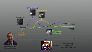 Automated MRI method to visualize blood flow in the heart