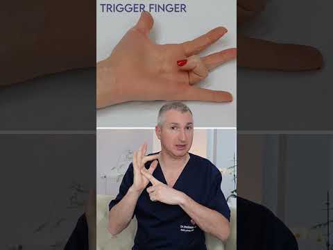 2 boli care blochează degetele #Dupuytren #trigger #Deget_blocat @DrVladislavGyebnar