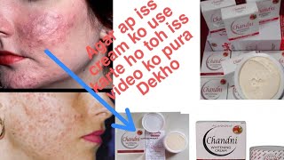 Chandni cream review and side effect Daraksha beauty care