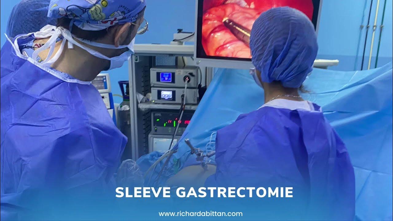 VIDEO EXPLICATIVE SLEEVE GASTRECTOMIE YouTube