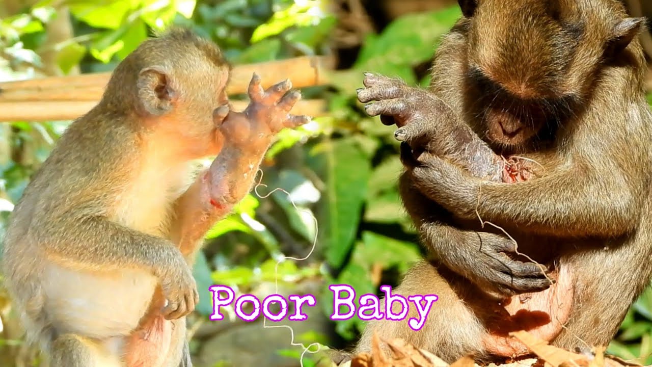 Very upset when see a Little Baby Monkey Serious injuries What a pity ...