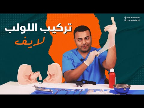 تركيب اللولب لايف