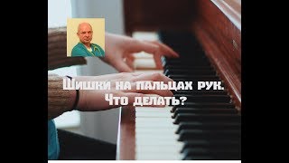 Шишки на пальцах рук.  Что делать?#шишкинапальцах