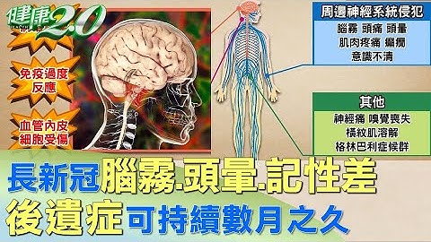 長新冠導致腦霧.頭暈.記性差 後遺症可持續數月之久 健康2.0 - 天天要聞