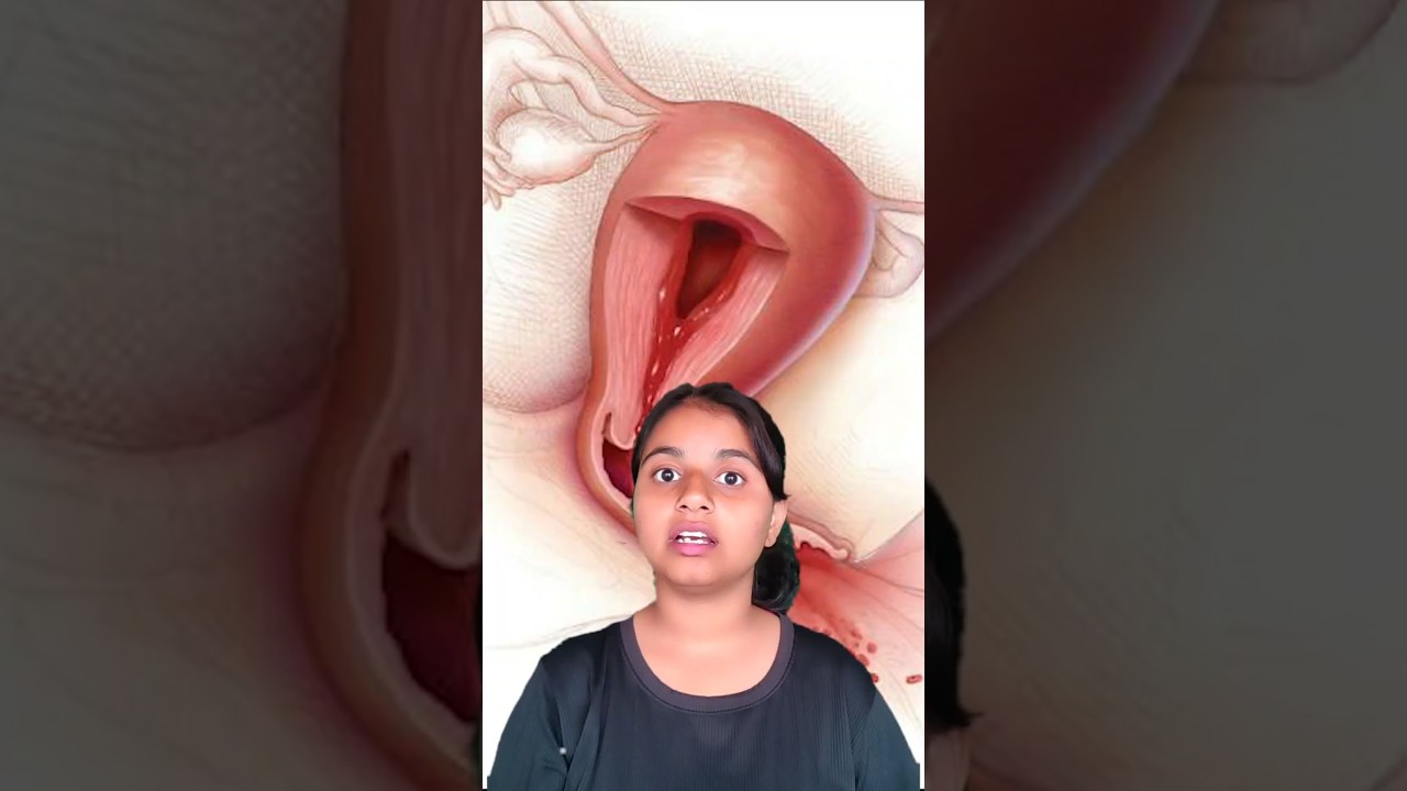 औरतें क्यों हटा रही है अपना uterus?#women #news #trending #health