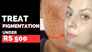 The 5 Best Products To Treat Pigmentation Under Rs 500 | Nipun Kapur