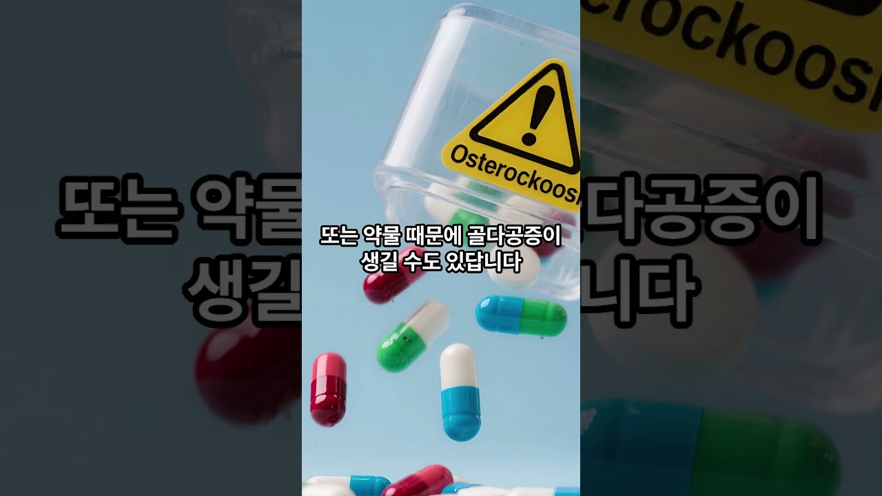 골다공증은 30대 후반 40대 빠른 검진이 가장 좋아요.