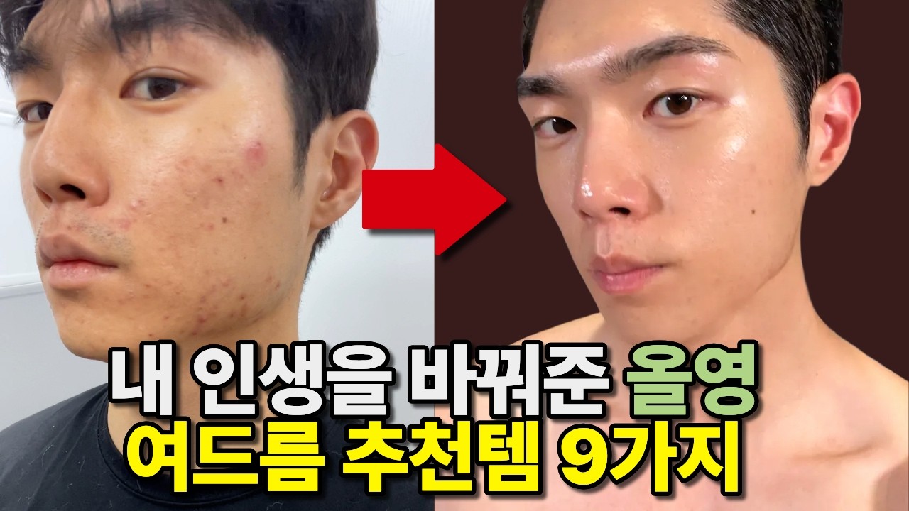 여드름 없애고 싶으면 올리브영에서 이거 사세요 (6월 올영세일 추천템)