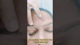 Chemical Cautery for Xanthelasma #shorts