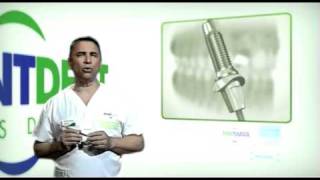 Implantología - Clinicas dentales Avantdent screenshot 3