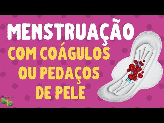 Sete causas da menstruação com pedaços de pele