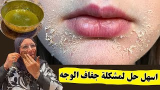 الى محلتيش مشكل جفاف الوجه 🥶 بلا متستعملي المكياج makeup او ماسكات التبييض 🙁 هذا اول علاج للبشرة 👉