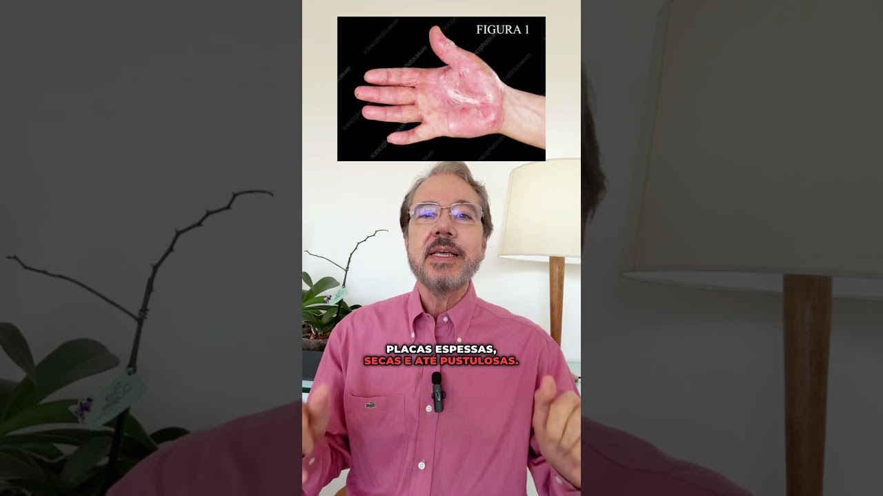 Lesões nas palmas das mãos