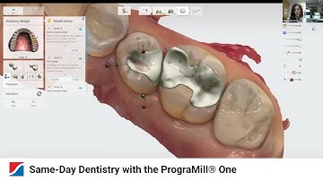 Same-Day Dentistry with the PrograMill® One
