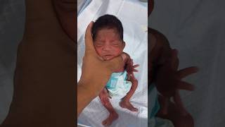 1 Day Baby What A Gorgeous Baby Premature Baby I Love Playing With Newborn Baby Nicu Care