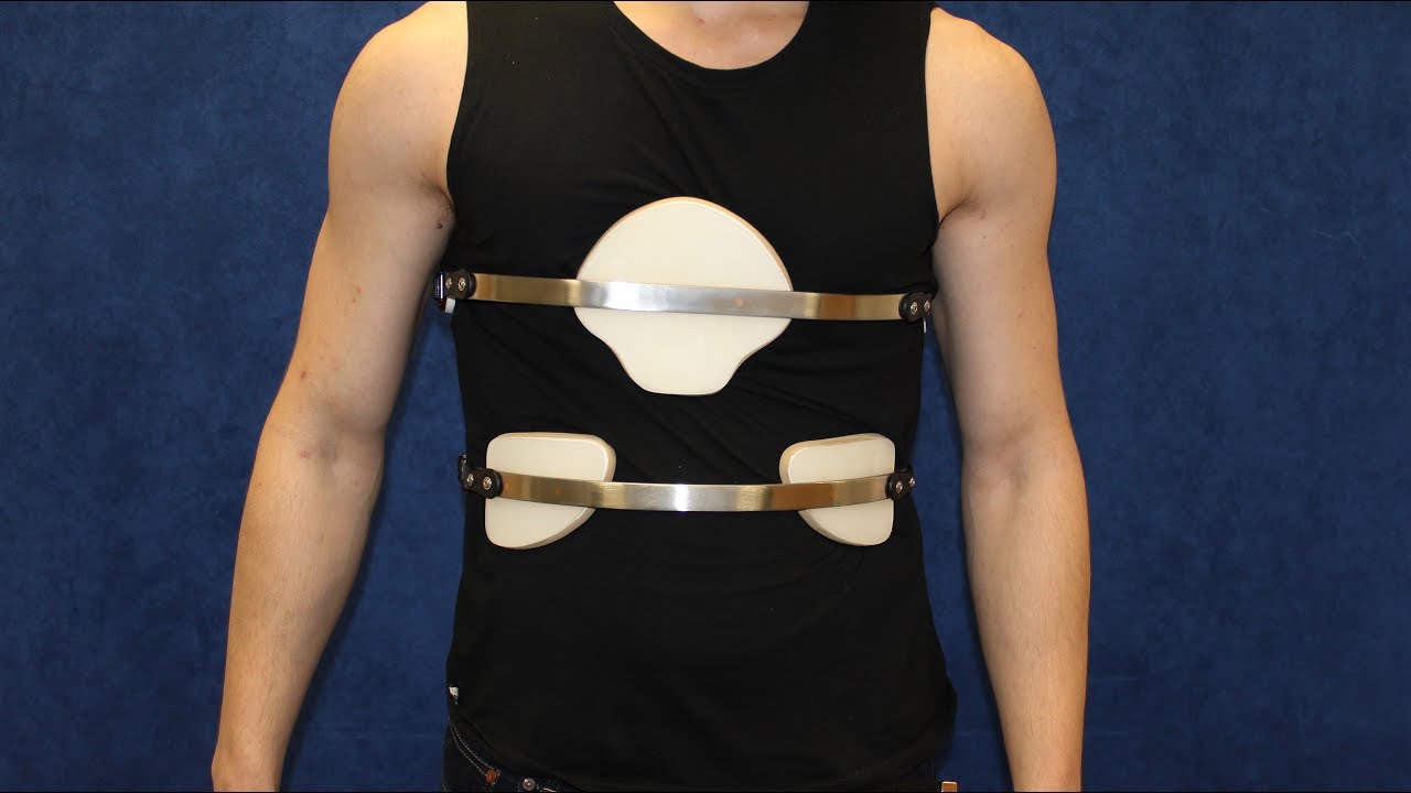 Pectus Deformity FAQs: How visible is the chest brace under clothing? 