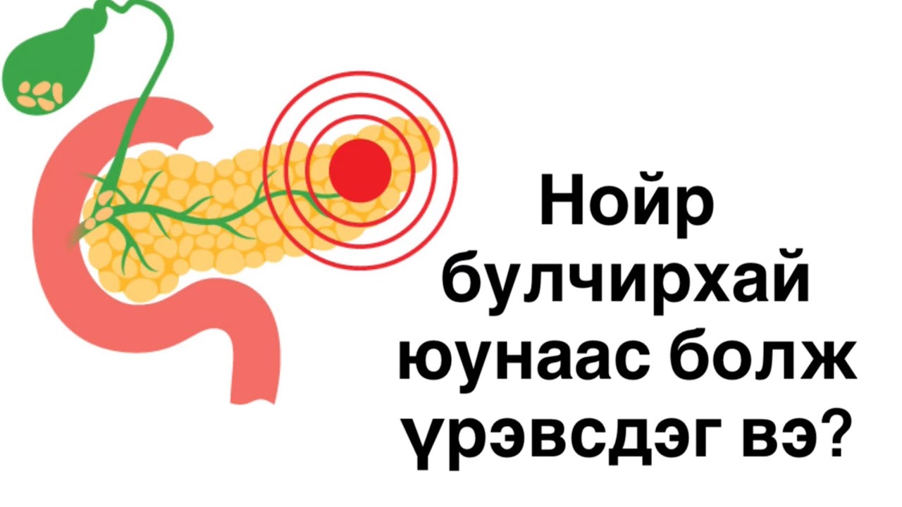 Нойр булчирхайн үрэвсэл юунаас болж үүсдэг вэ? 